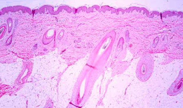 Histology slide of thin skin (histology-world.com).